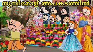 EPISODE 251 തുമ്പിമോള് അപകടത്തിൽ😮😭orupsychopoombatta parukutty serial cartoon malayalam story [upl. by Lahcear624]