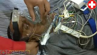 Sleep Study Polysomnography Full guide in Hindisnooring cause Sleep Study test procedure in Hindi [upl. by Nelhsa]