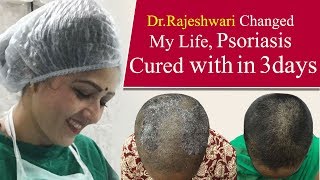 How To Cure Scalp Psoriasis Instantly  Dr Rajeshwaris Health Care [upl. by Ellehsal864]