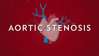 Aortic Stenosis in Seniors Explained [upl. by Ramyaj]