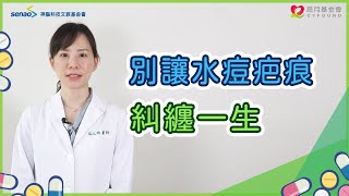 【流言健定團】水痘抓破一定會留疤嗎？消除水痘疤痕的方法有哪些？ [upl. by Maryellen587]