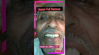 Upper Denture 🦷 [upl. by Xyno]