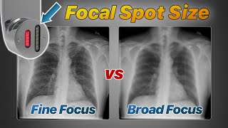 Focal Spot Size Explained Fine vs Broad Focus [upl. by Michaeline]