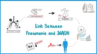 Understanding the Link Between Pneumonia and SIADH  it’s MyClinicalBook [upl. by Riba]