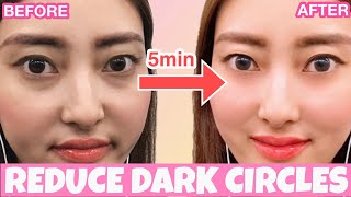 Reduce Dark Circles Wrinkles Under Eyes With This Massage [upl. by Frick]