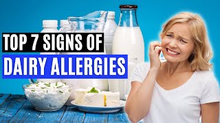 Top 7 Signs of a Dairy Allergy Signs of CMPA [upl. by Dnanidref]