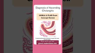 Diagnosis of Ascending Cholangitis  UKMLA Exam preparation  PLAB exam preparation  USMLE ukmla [upl. by Atika]