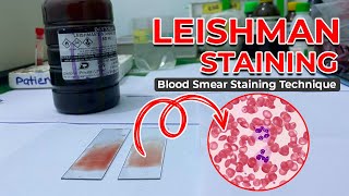 LEISHMAN STAINING  Blood Smear Staining Technique  Heamatology [upl. by Aldwin]