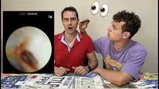 Cosa ha mio padre nellorecchio EAR WAX Marco [upl. by Lytle]