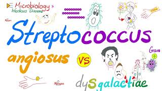 Streptococcus anginous vs Streptococcus dysgalactiae  Microbiology 🧫 amp Infectious Diseases [upl. by Corella]