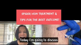 Spider Vein Sclerotherapy Treatment  Sharing Tips for the Best Outcome spiderveintreatment [upl. by Grim283]