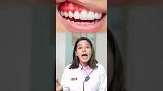 Everything you need to know about misaligned teeth  Aligners and braces  Clove Dental [upl. by Jordain]