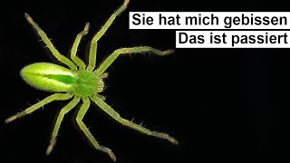 Spinne beißt mich 5 mal hintereinander [upl. by Rolecnahc]