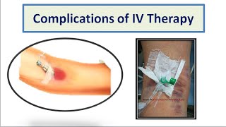 Complications of IV Therapy [upl. by Una280]