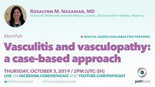 Vasculitis and vasculopathy  Dr Nazarian MGH DERMPATH [upl. by Ahcrop]