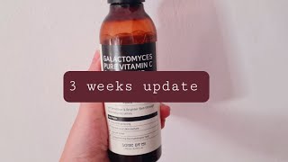 Some by mi galactomyces vitamin c glow toner 3 weeks update currycarikawaii [upl. by Baptiste259]