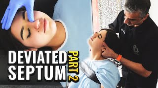 Years of difficulty breathing alleviated Deviated Septum Adjustment Part 2 DrRahim [upl. by Eilyac]