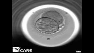 Time Lapse Embryo Imaging [upl. by Koblas]