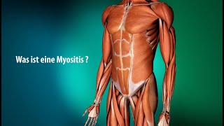 Erklärvideo Myositis [upl. by Desmond]