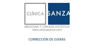 Medicina Estética  Corrección de ojeras con ácido hialurónico [upl. by Synn933]