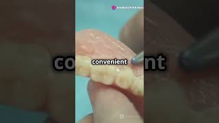 Removable Partial Denture Quick Guide  dentistry dentureimplants dentalcare [upl. by Wymore595]