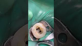 endodontist endodontics rootcanaltreatment rootcanaltherapy [upl. by Karlene481]