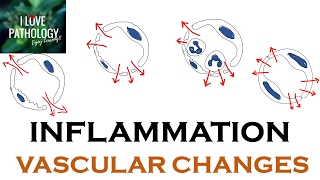 INFLAMMATION Part 1 General concepts types  Vascular changes in Acute inflammation [upl. by Nitsir]