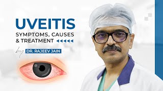 Uveitis  Causes Signs Symptoms Diagnosis amp Treatment  Dr Rajeev Jain  Delhi Best Eye Hospital [upl. by Ynotna]