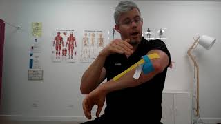 K Taping for Tennis Elbow [upl. by Reviere361]