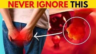 7 Signs and Symptoms Of Colon Cancer MUST WATCH [upl. by Friedland]