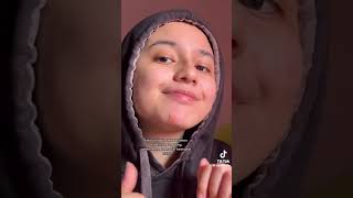 Pimple patch removal TikTok compilation [upl. by Aruol472]