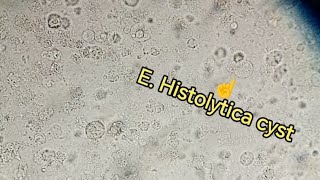 Entamoeba Histolytica trophozoite cyst Stool examination stoolanalysis gse stooltest [upl. by Bartolemo]