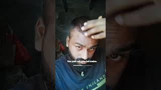 DAY 38  100 day hair regrowth challenge hairfall ytshortsvideo [upl. by Juback227]