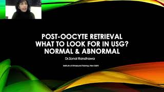 Post oocyte retrieval What to look for in USG [upl. by Strephon]