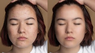 Smoothen Your Skin in 1 Click  High End Skin Retouching Tutorial [upl. by Maurey]