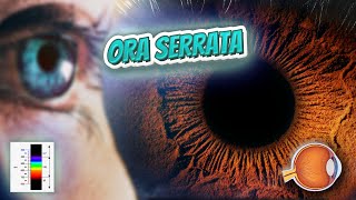 Ora serrata  Your EYEBALLS  EYNTK 👁️👁️💉😳💊🔊💯✅ [upl. by Ingraham184]