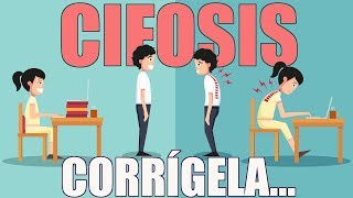 Corrige la CIFOSIS en 3 pasos  Higiene Postural [upl. by Ner]