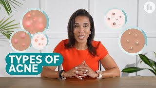 The Different Types of Acne and How to Treat Them [upl. by Eissim939]