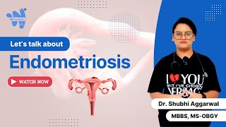 Endometriosis  Causes Symptoms amp Treatment [upl. by Hcirdla]