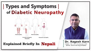 Diabetic Neuropathy Types amp Symptoms You Need to Know  Dr Ragesh Karndiabeticneuropathy [upl. by Gayleen94]