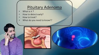 Pituitary adenoma  Early symptoms Diagnosis and Treatment Explanation by Dr SkandaNeurosurgeon [upl. by Gora703]