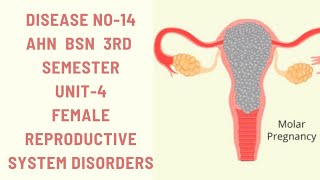 Hydatidiform MoleMolar pregnencyDisease14AHNBSN 3rdsemester Unit4female reproductive disorders [upl. by Ward]