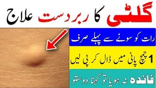 Gilti ka ilaj in Urdu  Lipoma Ka Desi ilaj by Healthin [upl. by Cindi]