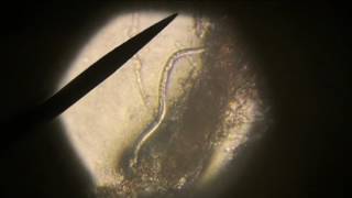 Plant Root Nematodes [upl. by Oirevlis]