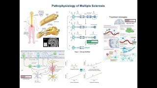 Multiple Sclerosis Pathophysiology and Treatment [upl. by Benia]