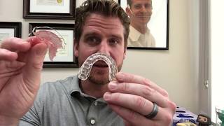 What Is The Best Orthodontic Retainer [upl. by Atul]