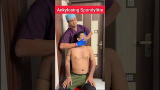 The Expert Treatment to Ankylosing spondylitis PTAnindya [upl. by Milissa81]