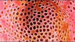 Trypophobia Test 1 [upl. by Yreved]