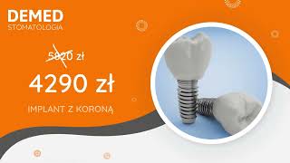 Promocja implant korona 4290 zł [upl. by Islaen848]