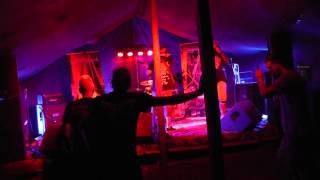 Epicardiectomy live  Arsch Cholio 2014 [upl. by Ewell]